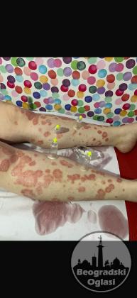 Hidzamom do balansa, Jaca